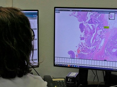 El projecte DigiPatICS consolida l’ús de la IA per millorar el diagnòstic del càncer i compartir resultats