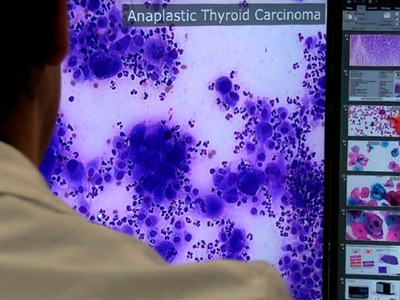 Algorithms for cancer diagnosis, a greenhouse gas catalyst and the spin-off Virmedex receive awards